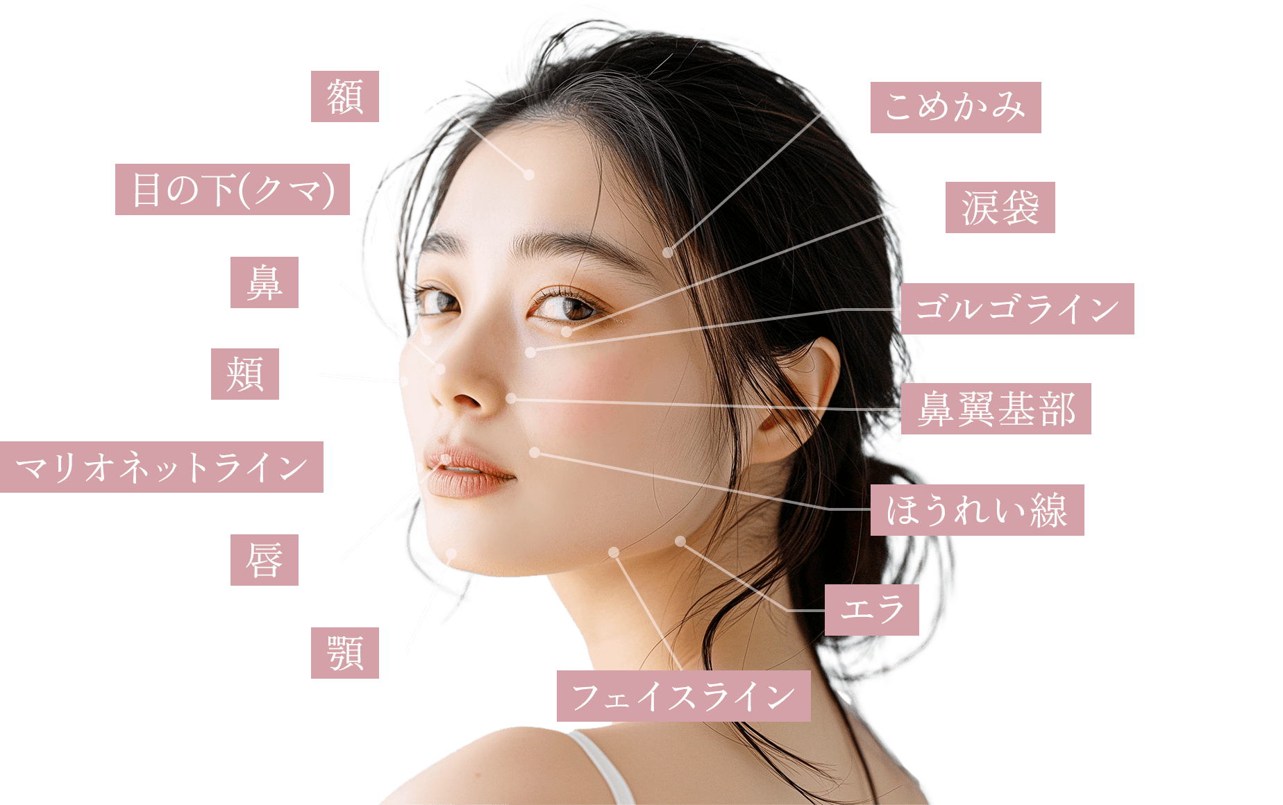 注入箇所の図