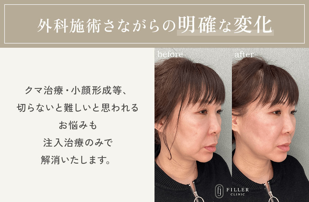 外科施術さながらの明確な変化