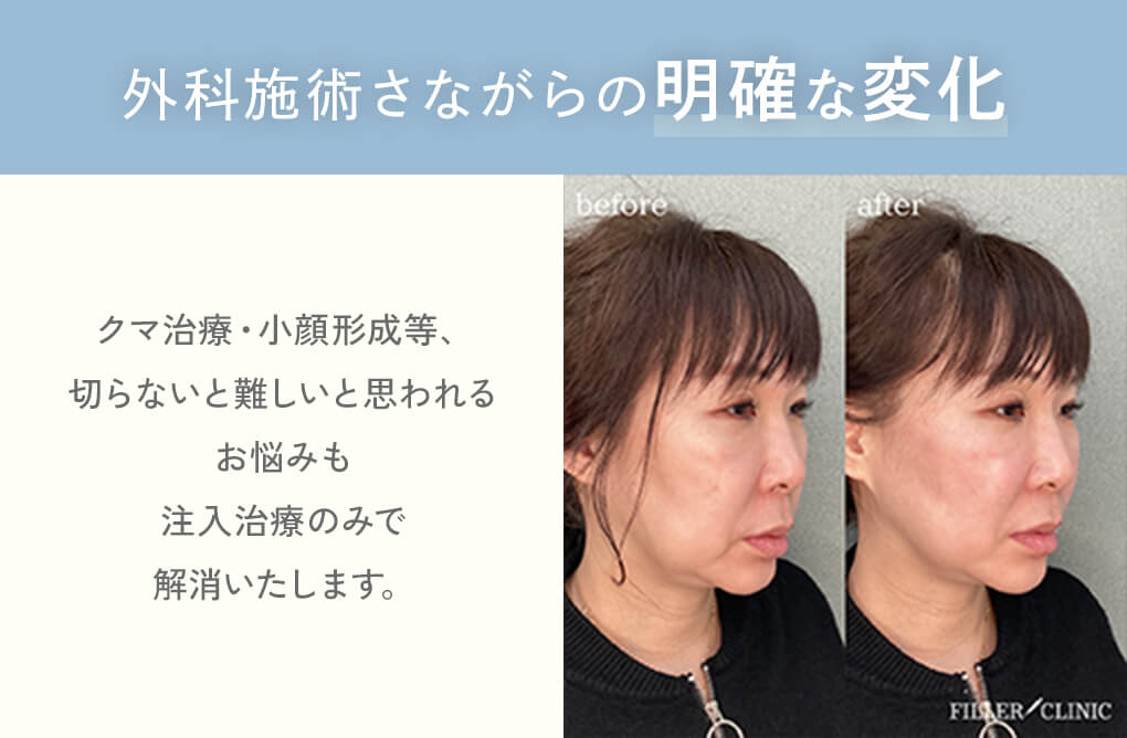 外科施術さながらの明確な変化
