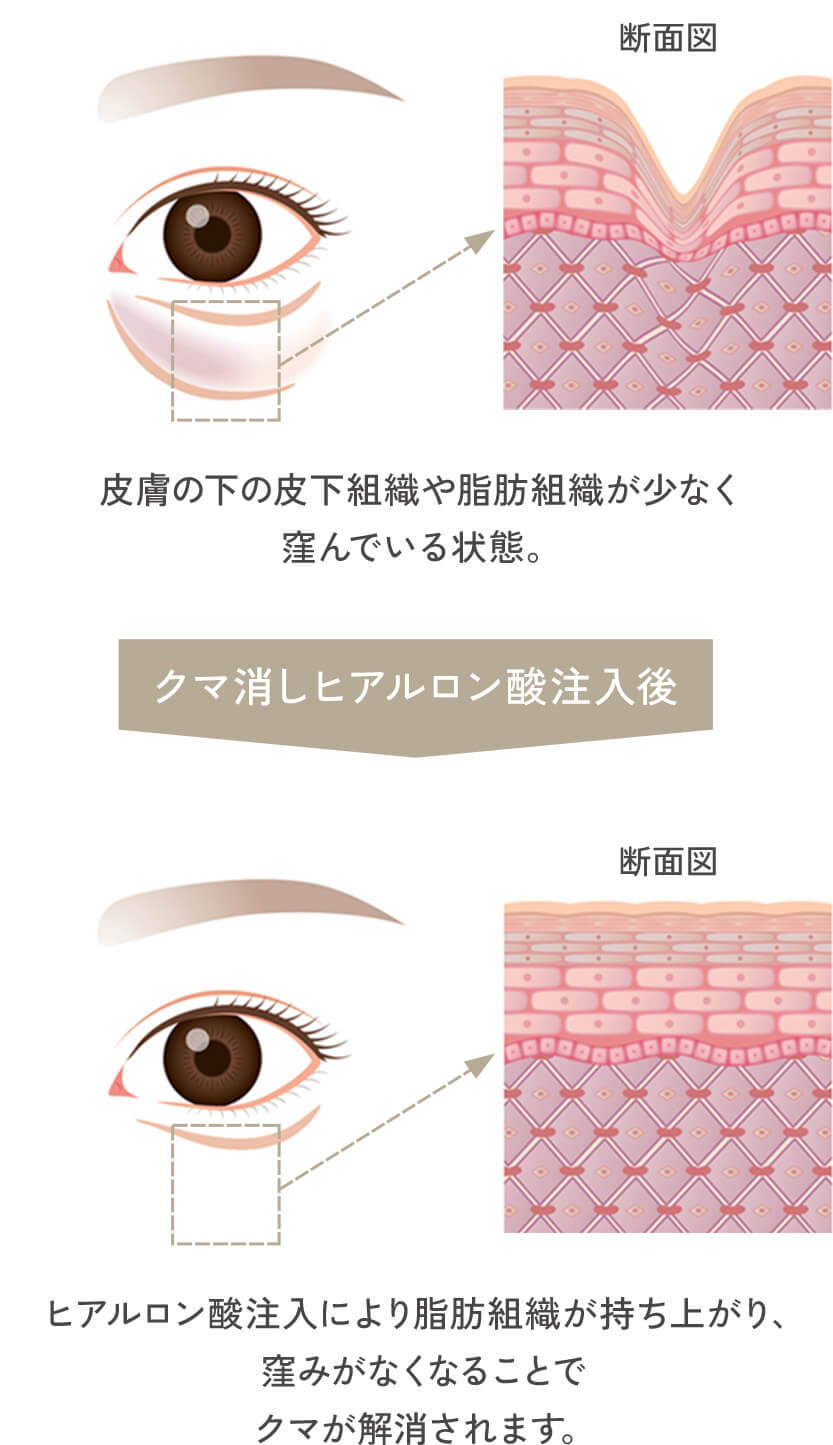 手術イメージ